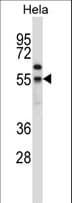Polyclonal Rabbit anti-Human FOXN4 Antibody (aa1-30, WB)