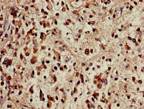 Polyclonal Rabbit anti-Human TRF1 / TERF1 Antibody (IHC)