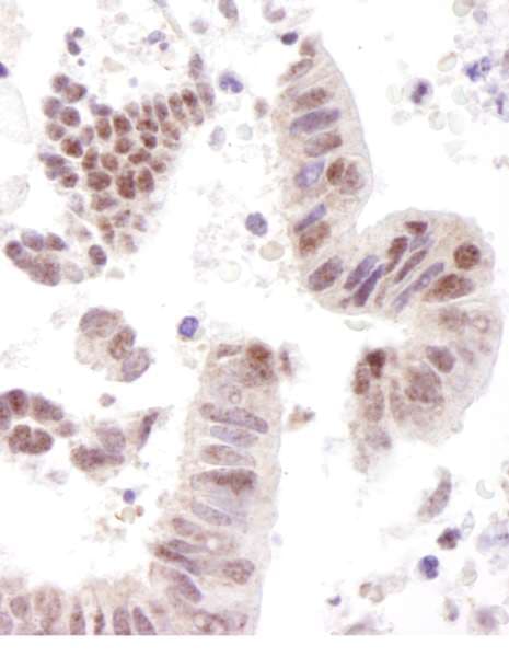 COAA / RBM14 Antibody (aa150-200)