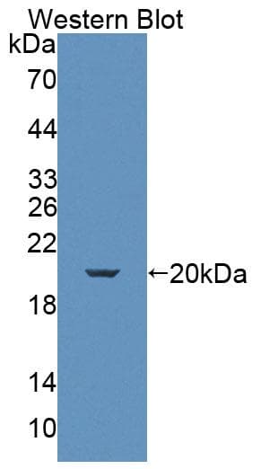 KLRK1 / CD314 / NKG2D Antibody (aa90-232)