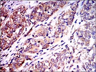 Monoclonal Mouse anti-Human NF-L / NEFL Antibody (clone 1H3, IHC, IF, WB)
