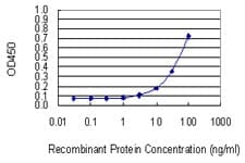 UCK2 Antibody (clone 1G12)
