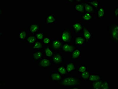 Polyclonal Rabbit anti-Human HIST1H2BN Antibody (IHC, WB)