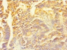 SNCG / Gamma-Synuclein Antibody (aa1-127)