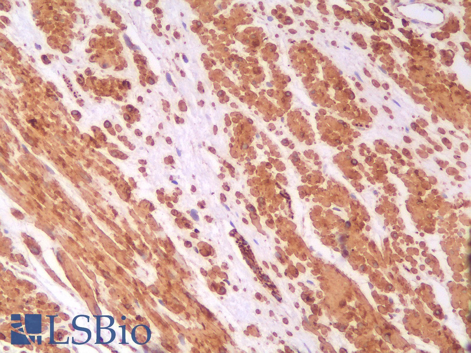 PathPlus™ DES / Desmin Antibody (clone DES/2960R)