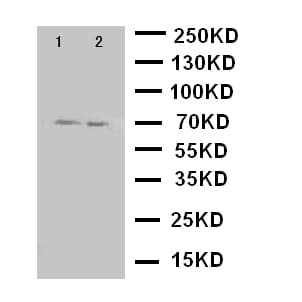 PRLR / Prolactin Receptor Antibody (aa591-605)