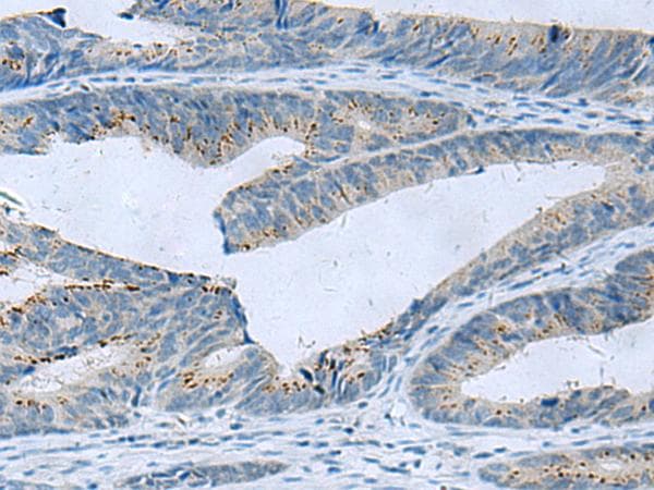 GLS / Glutaminase Antibody