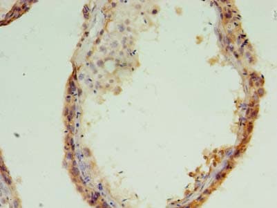Polyclonal Rabbit anti-Human MED28 / Magicin Antibody (IHC)