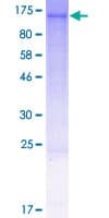 Human GLTSCR1L / KIAA0240 Protein (Recombinant GST)