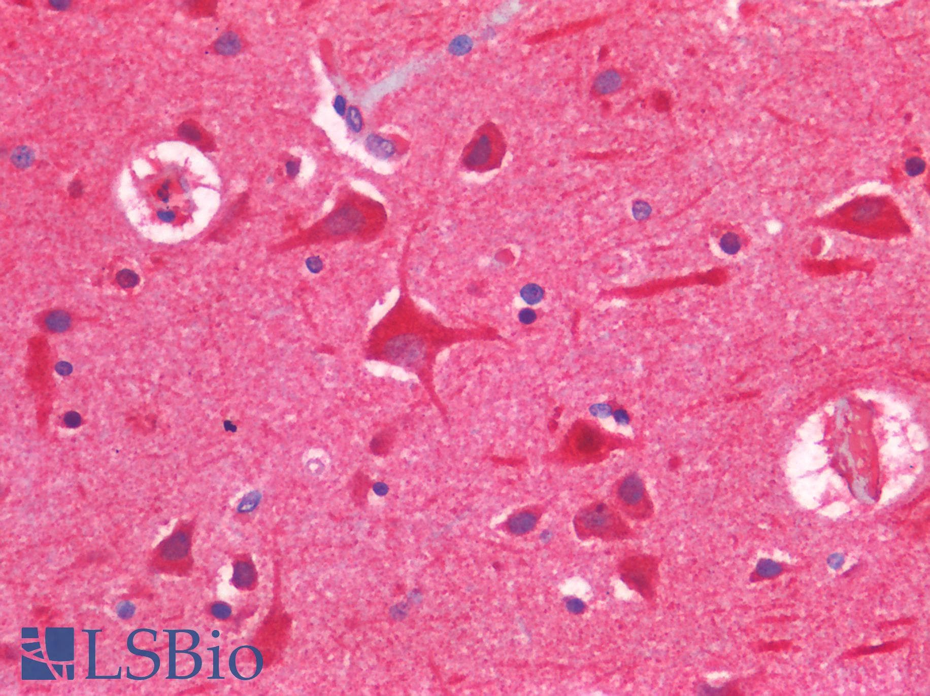 IHC-plus™ Polyclonal Rabbit anti-Human TP53 / p53 Antibody (IHC)