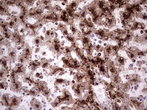 Monoclonal Mouse anti-Human CD63 Antibody (clone OTI7F1, IHC)