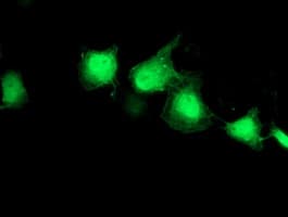 EIF2B3 Antibody (clone OTI1H3)