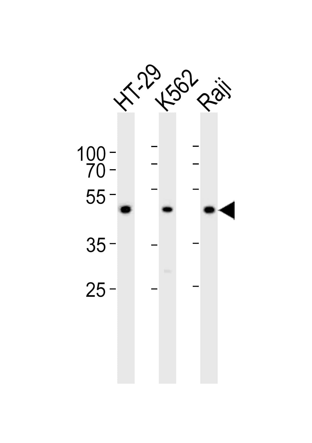 IL13RA1 / IL13R Alpha 1 Antibody (aa207-238)