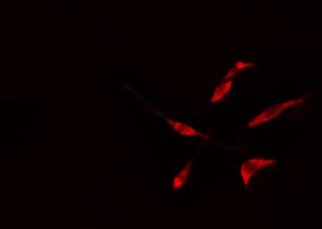 ALY / THOC4 Antibody