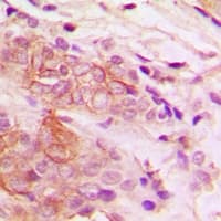 SMYD5 Antibody