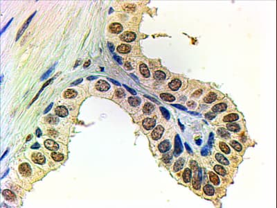 Polyclonal Goat anti-Human AR / Androgen Receptor Antibody (aa2-16, IHC, IF, WB)