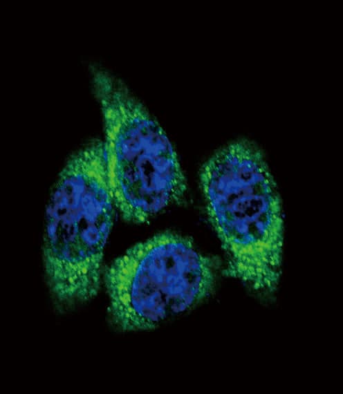 IHC-plus™ Polyclonal Rabbit anti-Human CYP17 / CYP17A1 Antibody (aa358-388, IHC, IF, WB)