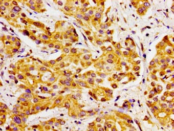 Polyclonal Rabbit anti-Human CYP27 / CYP27A1 Antibody (IHC)