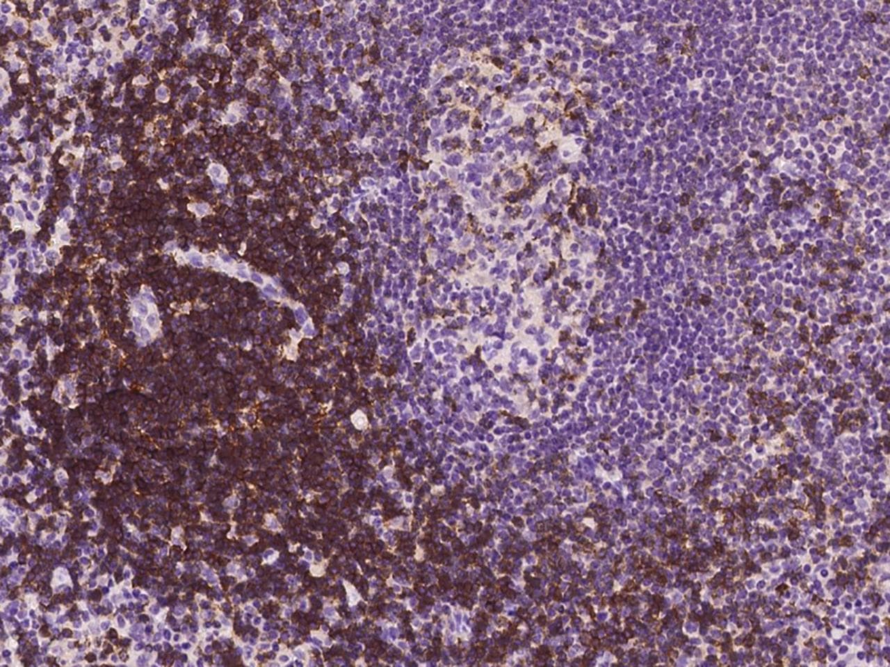 CD6 Antibody