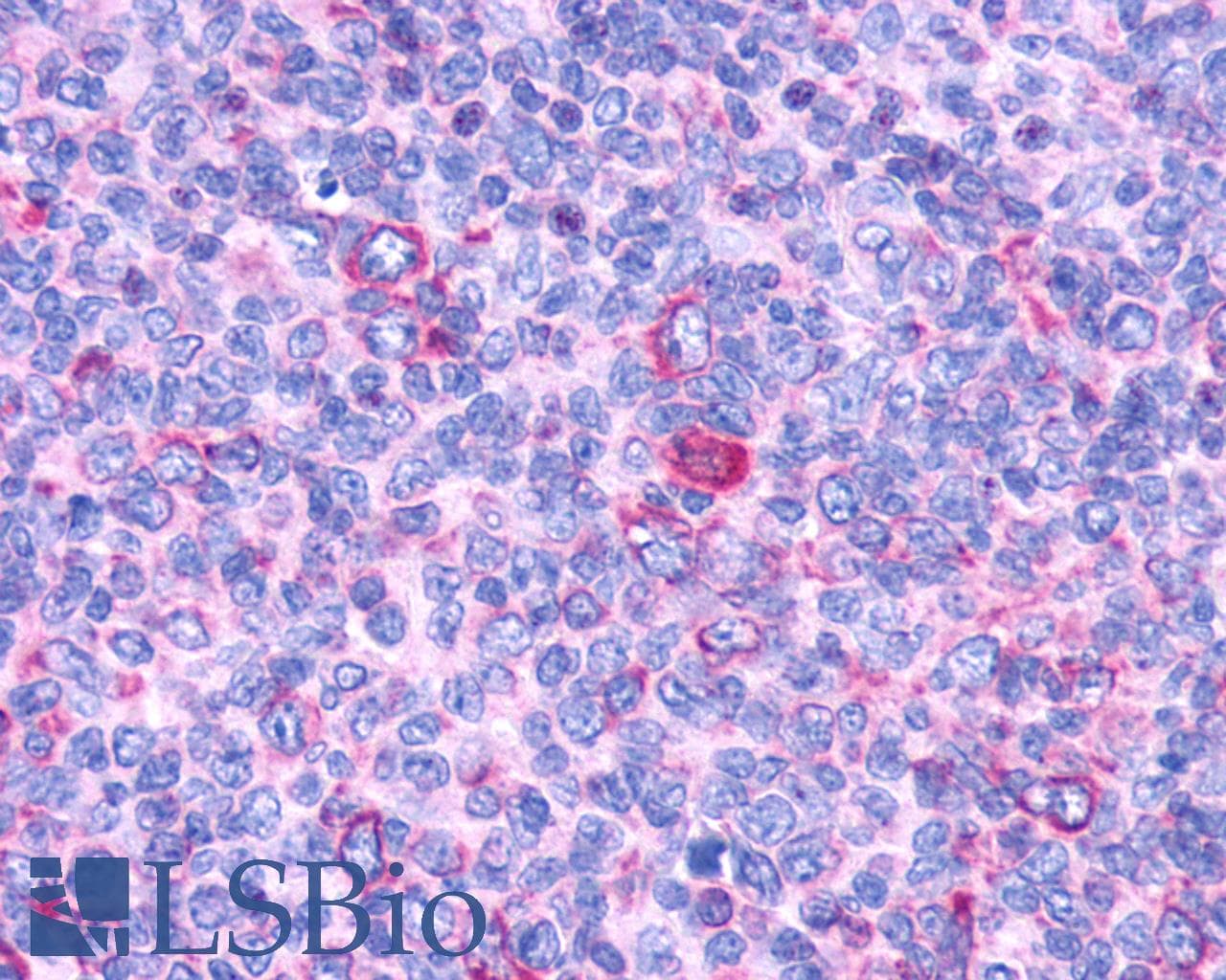 PathPlus™ GPR132 / G2A Antibody (Cytoplasmic Domain)