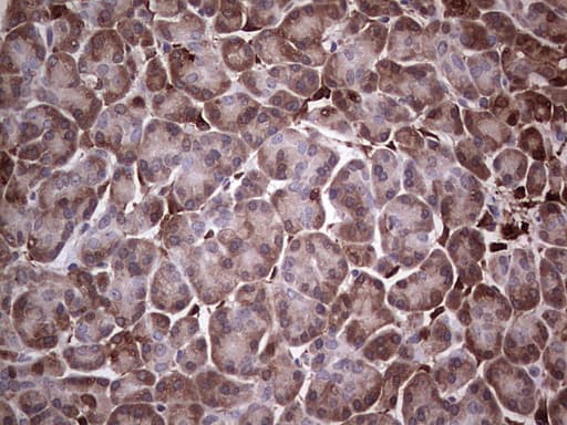 Monoclonal Mouse anti-Human LGALS3 / Galectin 3 Antibody (clone OTI15E4, Carrier-free, IHC, WB)