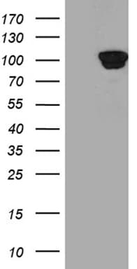 PYGM Antibody (aa698-842, clone OTI3C11)