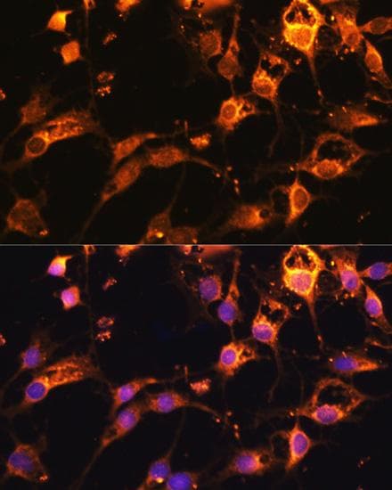 DNM1L / DRP1 Antibody