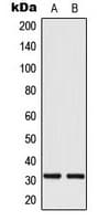 MRPL24 Antibody (Internal)