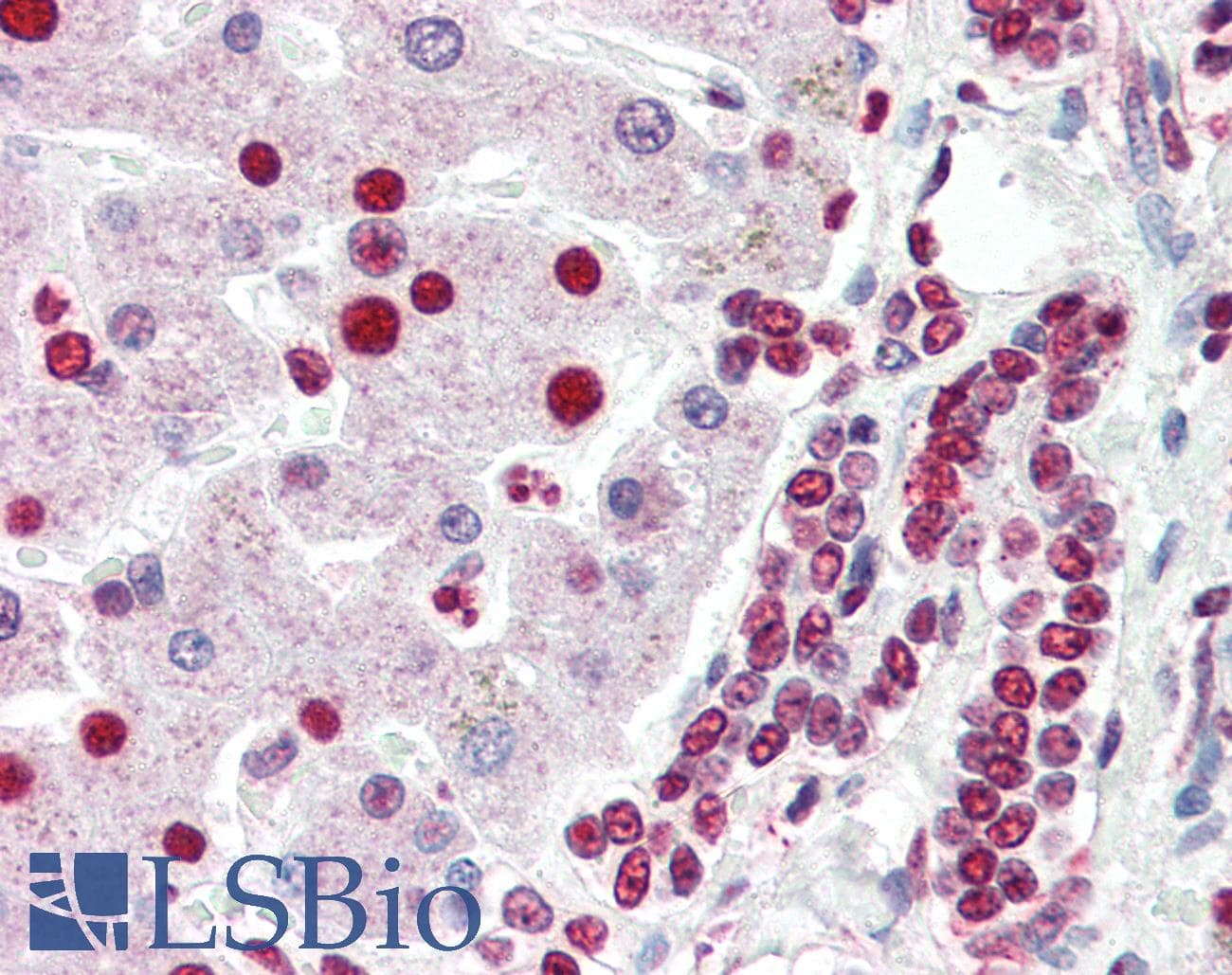 IHC-plus™ PHAP1 / ANP32A Antibody
