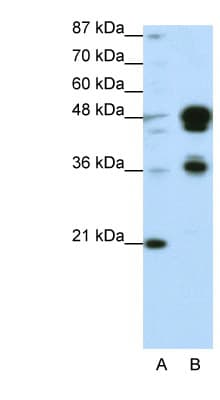 Polyclonal Rabbit anti-Human FOXA1 Antibody (aa395-444, IHC, WB)