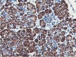 NUDT18 Antibody (clone OTI1A5)