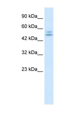 P2RX2 / P2X2 Antibody (aa55-104)
