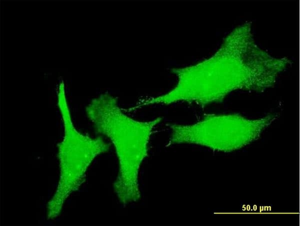 Monoclonal Mouse anti-Human CSRP3 Antibody (clone 6D2, IF, WB)
