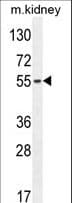 IHC-plus™ FBXO39 Antibody (aa385-414)