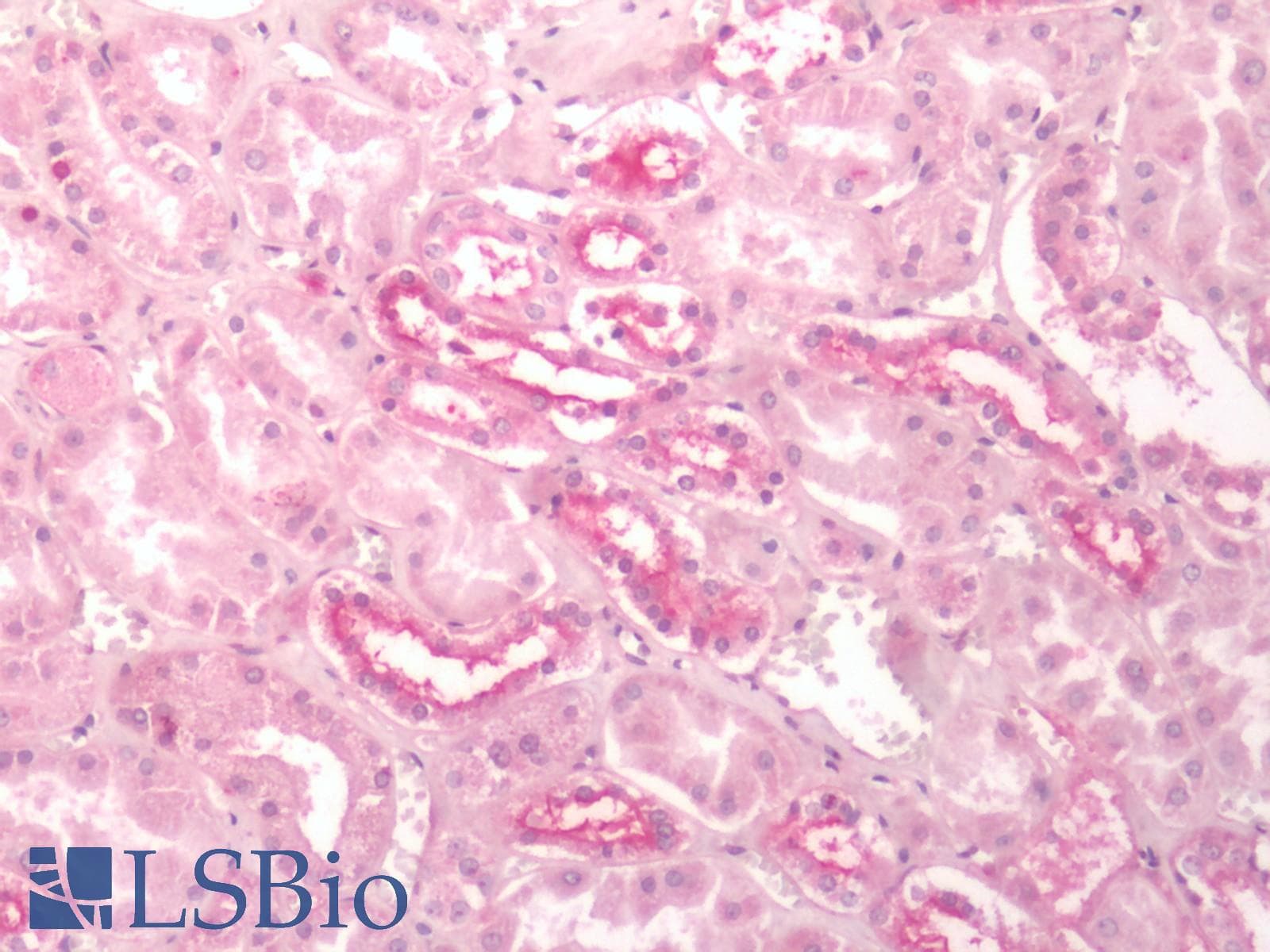IHC-plus™ Polyclonal Rabbit anti-Human ADGRD1 / GPR133 Antibody (C-Terminus, IHC)