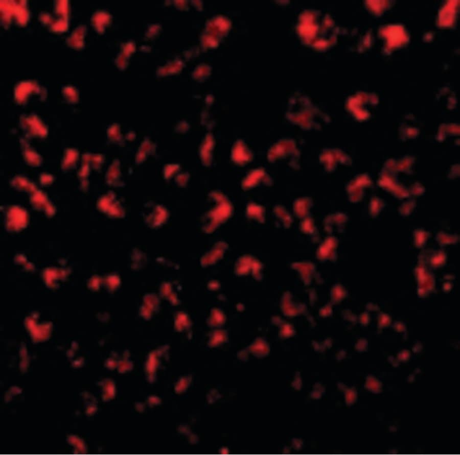 Polyclonal Rabbit anti-Human CCL11 / Eotaxin Antibody (IF, WB)