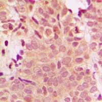 HDAC5 Antibody (Internal)