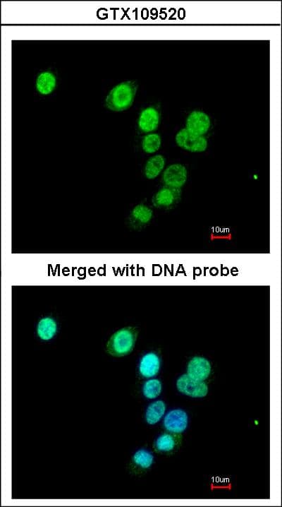 Polyclonal Rabbit anti-Human RASAL1 / RASAL Antibody (aa516-787, WB)