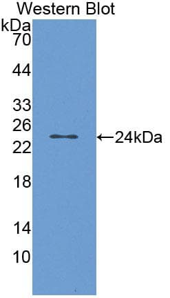 Polyclonal Rabbit anti-Human VR1 / TRPV1 Antibody (PE, aa1-153, WB)