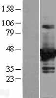 DOK2 Protein (Over-Expression Lysate Myc-DDK (Flag))