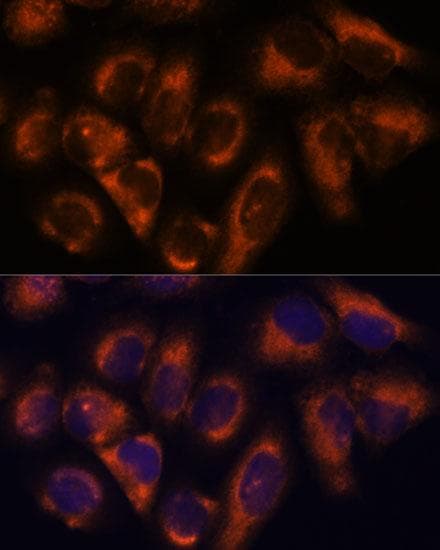 NDRG4 Antibody