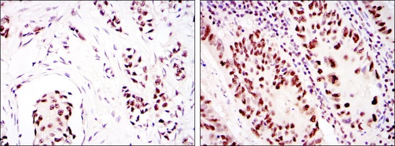 Monoclonal Mouse anti-Human PRKDC / DNA-PKcs Antibody (clone 3H6, IHC, IF, WB)