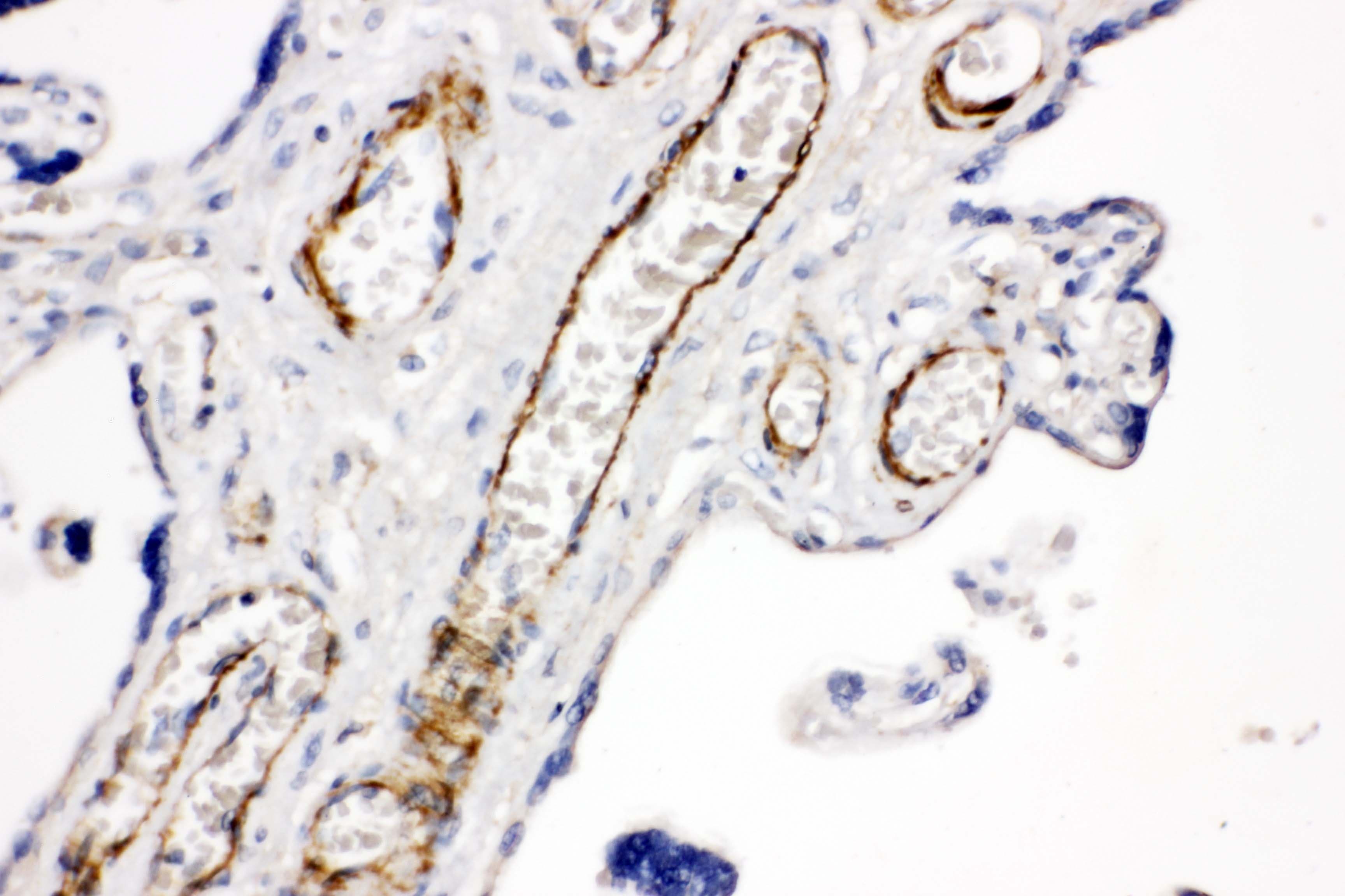 Polyclonal Rabbit anti-Human HMMR / CD168 / RHAMM Antibody (aa706-724, IHC, WB)