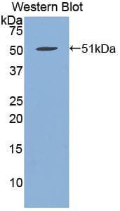FBN1 / Fibrillin 1 Antibody (aa723-902)