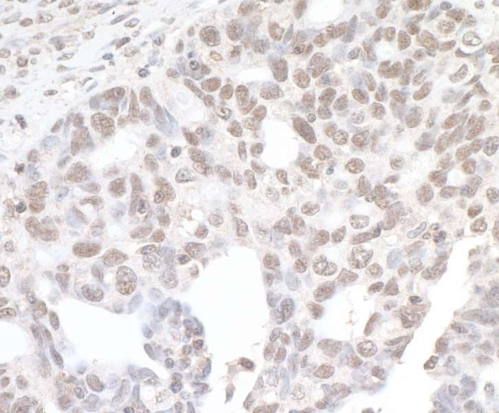 BRD4 Antibody (aa1312-1362)