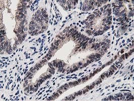 Dipeptidyl Peptidase 3 / DPP3 Antibody (clone OTI2D9)