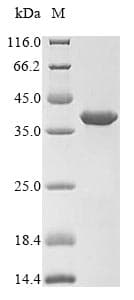 Mouse UPK2 / UPII / Uroplakin 2 Protein (Recombinant GST-6His, N-terminus)