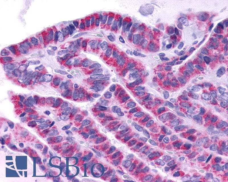 PathPlus™ TSH Receptor / TSHR Antibody (N-Terminus)
