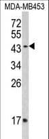 Polyclonal Rabbit anti-Human IFNGR2 Antibody (aa308-337, IHC, WB)