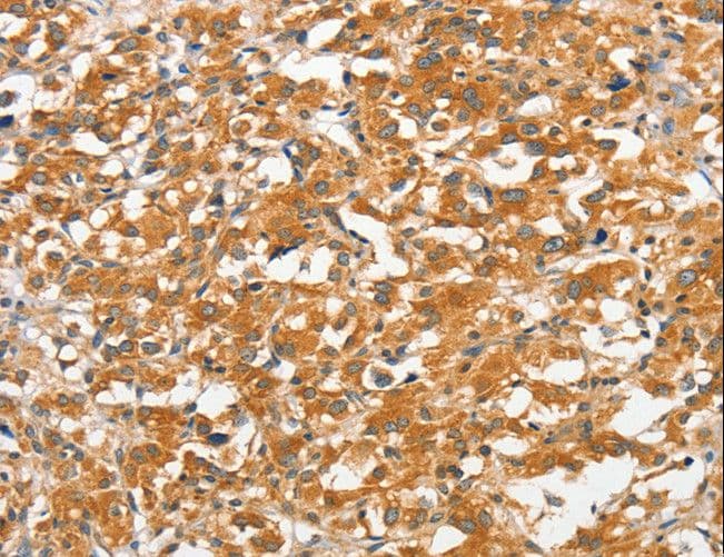 ANKMY2 Antibody